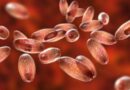 EUA têm mais um caso de peste bubônica em novo estado americano enquanto autoridades pedem que a população esteja em alerta